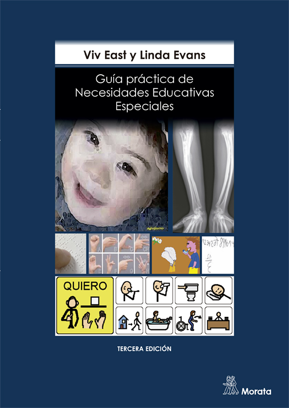 El racismo