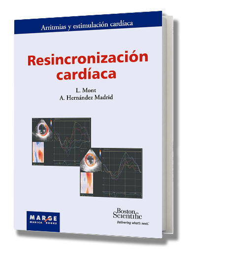 Resincronización cardíaca