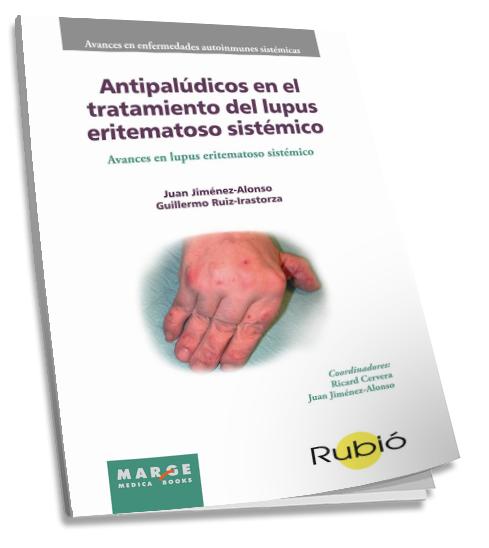 Antipalúdicos en el tratamiento del lupus eritematoso sistémico