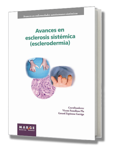 Avances en síndrome antifosfolipídico