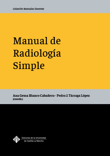 Radiología de mama, 4.ª Edición